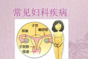 妇科问题佛教怎么讲 佛教看待妇科病