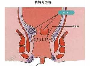 佛教徒邪话 佛教 邪术害人的报应