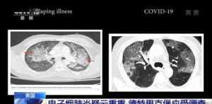 佛教说新冠肺炎是什么因果 佛教如何解释冠状肺炎