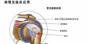 治前列腺炎的咒语 佛教前列腺炎