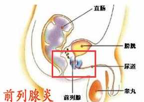 治前列腺炎的咒语 佛教前列腺炎