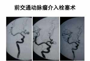 佛教解释脑血管病 佛教解释脑血管病的意思