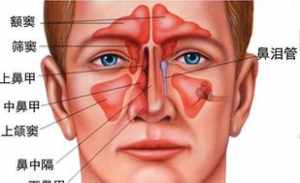 佛教讲鼻囊肿 鼻囊肿治疗方法