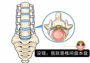 佛教中死于心脏病 佛学心脏病怎么造成