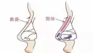 佛教肛门呼吸术怎么做 佛教肛门呼吸术