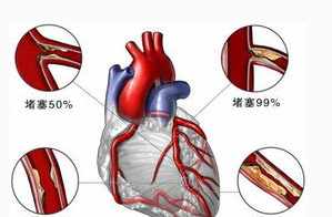 佛教冠心病怎样调理 佛教对心脏病解释