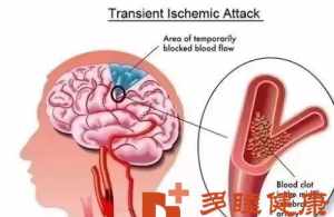 佛教脑梗塞怎么办 佛家说脑梗是什么因果