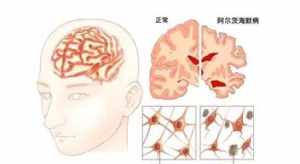 佛教眼疾是什么原因 佛教说眼睛疾病因果