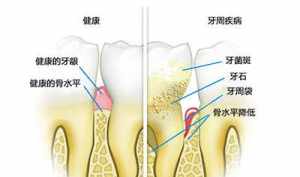 牙齿不全的因 佛法 佛教牙齿不好什么因果