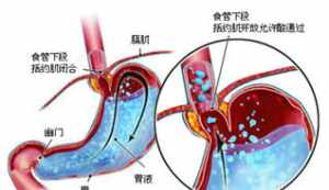 佛教不能吃 佛教让食痦子吗