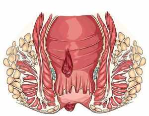 痔疮是怎么来的佛教解释 为什么生痔疮佛教