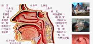 佛教治咽喉炎 佛法治疗咽炎