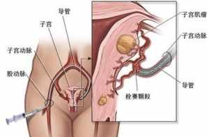 佛教治疗妇科 佛教治疗妇科病的感应