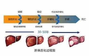 乙肝的前世因果 乙肝佛教因果