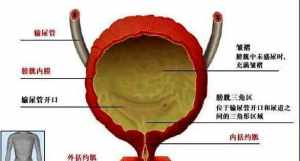 佛教中治膀胱炎 治疗膀胱炎的偏方