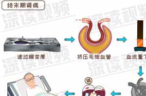 佛教开示尿毒症的因果 佛教如何看待尿毒症