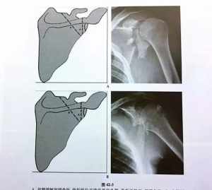 佛教治近视咒语 佛教治近视的咒