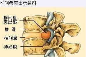 佛教讲腿疼的因果? 佛教里腿疼是什么原因