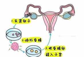 佛教如何解释试管婴儿 佛教不孕试管