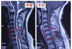 佛教颈椎病的因果 佛教颈椎病是什么业力