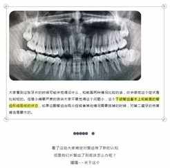 佛教智齿 佛教关于长智齿的解释