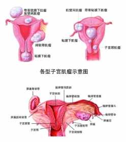 佛教妇科病是什么因果病 佛教讲妇科疾病的因果