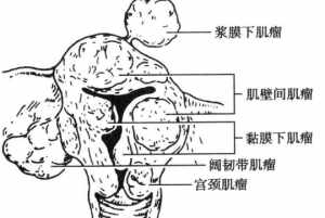 妇科病在佛教是什么业障 女人妇科病在佛教里