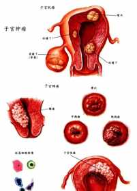 佛教说妇科病的因果 佛教说妇科病