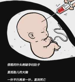 死胎与佛教 死胎的因果报应