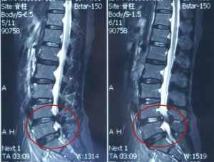 佛教治疗腰椎间盘突出的咒语 腰椎盘佛教