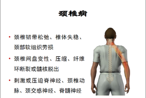 哪个佛咒治颈椎病 佛教可以治疗颈椎病吗