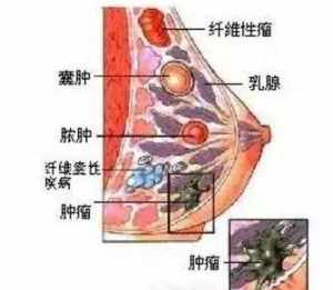 包含瘤佛教的词条