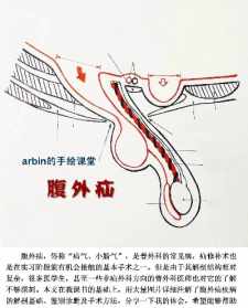 佛经说疝气是什么因果 佛教治疝气