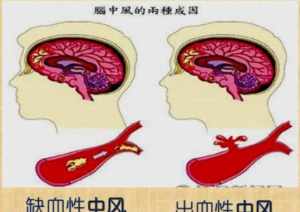 佛教中风代表什么关系的人 佛教中风代表什么关系