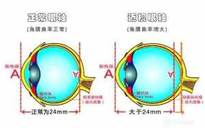 玩电脑近视度数会加深的很厉害吗 玩电脑能近视佛教