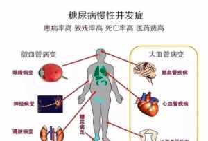 佛法这样治疗糖尿病 佛法根治糖尿病