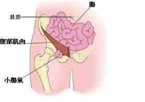 小孩得疝气是不是遗传 佛教解释孩子得疝气