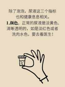 请问尿液发黄有泡沫什么原因 有没有那种既沙雕又搞怪的朋友圈文案