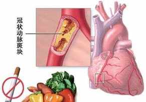 佛教冠心病怎样调理 冠心病咒语