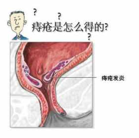 佛治痔疮咒全文 佛教治痔疮