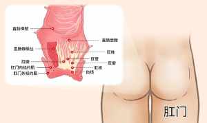 肛门痉挛怎么治疗方法 肛门痉挛学佛