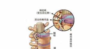 学佛治浑身疼 学佛人享受病痛