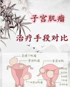 佛说疗痔病经治子宫肌瘤 佛法治疗子宫肌瘤