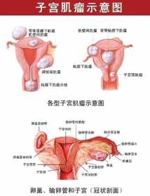 佛说疗痔病经治子宫肌瘤 佛法治疗子宫肌瘤