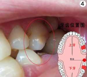 佛教智齿不拔会有什么影响吗 佛教智齿