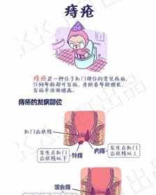 痔病经学佛网 佛说痔疮病经全文读诵