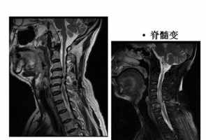 颈椎病治疗佛法 佛教治疗颈椎病的咒语