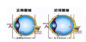 佛教怎么治疗近视 佛教怎么治疗孩子的视力