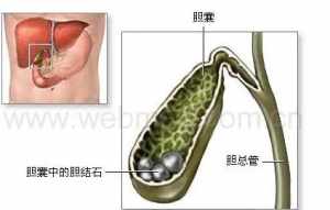 佛教讲结石的业障 怎样用佛法来治病结石病