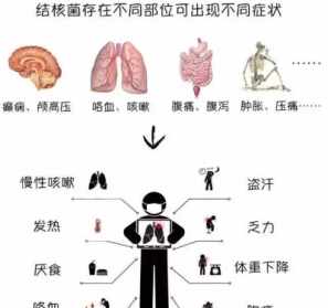 佛教怎么治肺结核 佛教治疗各种疾病的方法